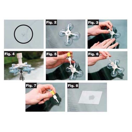  Windscreen Repair Kit - UO20400-1 